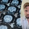 Baanbrekende studie versnelt diagnose van hersentumoren: “De diagnose klopt in 9 op de 10 gevallen”