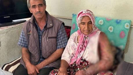 Kolu şişti, vücuduna kadar yara oldu: 4 çocuk annesinin zorlu yaşamı