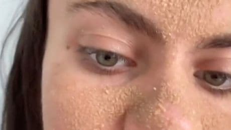 Kuriose Art der Hautpflege - Tia hat sich seit März das Gesicht nicht gewaschen