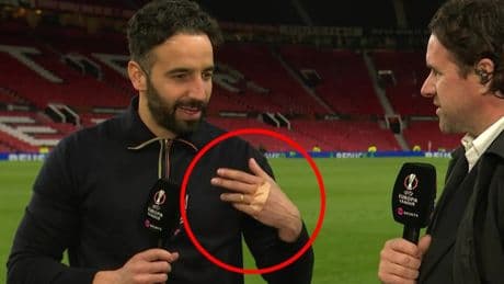 Amorim spotted with plaster on knuckles after half-time as Man Utd fans say ‘anyone checked the TVs in changing room?’