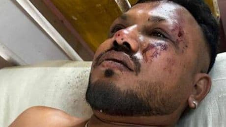 El pasajero del asiento 11A, único superviviente al accidente de Air India: "Se oyó un fuerte ruido y el avión se estrelló. Todo sucedió rapidísimo"