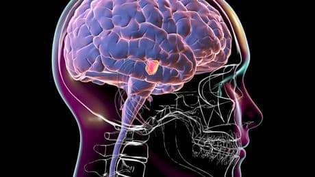 Ein neuer Hoffnungsträger für die Früherkennung von Parkinson