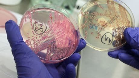 Hallan por primera vez una explicación al aumento del cáncer de colon en jóvenes: esta bacteria silenciosa