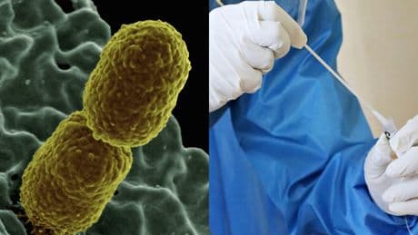 Serratia marcescens, il batterio killer: sintomi, cosa è e come si trasmette. È fra le prime 10 cause di infezioni ospedaliere