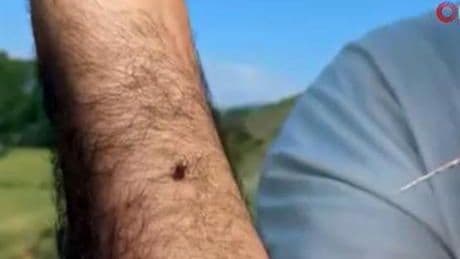Kentte ürperten görüntü! Keneler adeta kovaladı: Radarına girince kaçamıyorsun
