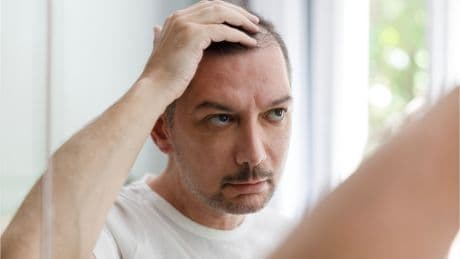 Studie zeigt: Beliebte Getränke lassen die Haare ausfallen – vor allem bei Männern
