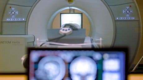 Man pulled into MRI machine after he walked into an exam room wearing a chain necklace