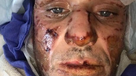 Dad "burned alive" at house party after row with stranger left fighting for life