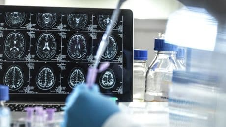 Why I’m glad the NHS has rejected two Alzheimer’s ‘wonder drugs’