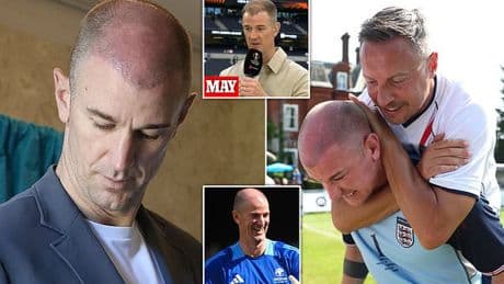 Former England goalkeeper Joe Hart sports fresh scars of hair transplant at Soccer Aid... in a far cry from his days in Head and Shoulders adverts!