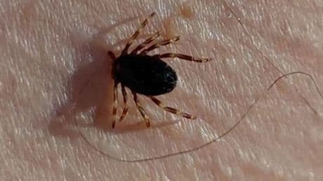 Sivas'ta KKKA alarmı! 6 kişi tedavi altında