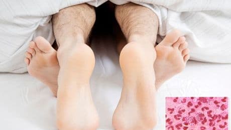 Super Gonorrhoea breakthrough as new antibiotic works against mutant STI on the rise in Britain