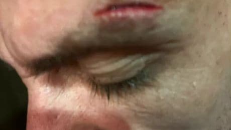 British dad-of-two was ‘beaten up twice in hotel’ in front of his children during ‘nightmare’ Turkish holiday