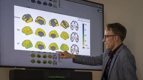 Personalised dementia tests could be available ‘within 5 years’