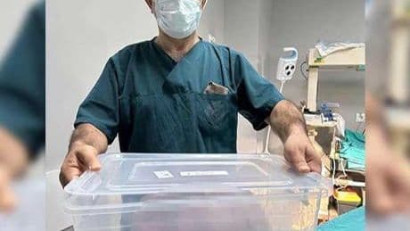 Ameliyat masasında büyük şok! 9 kilo ağırlığında kile çıkartıldı