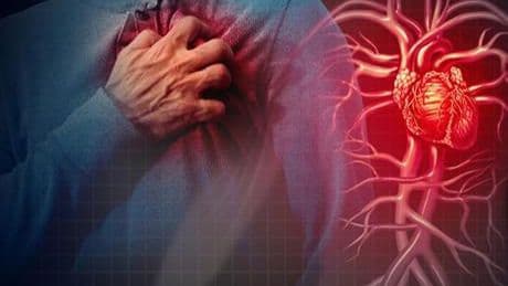 Damarları koruyan öneriler! 'Bir gün sağlıklı görünen kişi, ertesi gün kalp krizi geçirebilir'