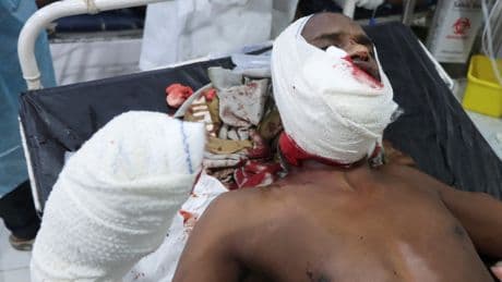Un bombardeo de EE UU contra un centro de detención de migrantes en Yemen causa al menos 68 muertos