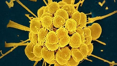 Tripper: Neu entwickeltes Antibiotikum wirkt gegen resistente Erreger