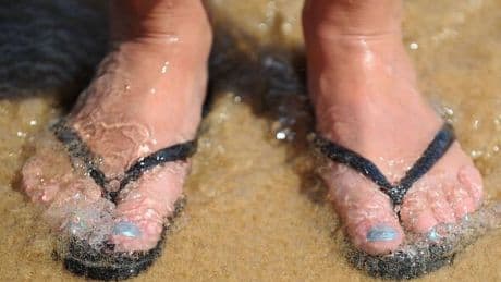 People urged to seek medical help if heatwave swollen ankles do one thing