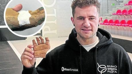 Un universitario vizcaíno encuentra un material que reduce el dolor en las manos de los pelotaris