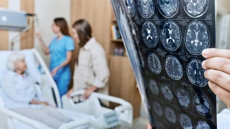 ¿Cómo puede ayudar la IA en la endocarditis infecciosa?