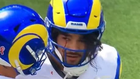NFL star Puka Nacua bleeds from the EYE before concussion check in scary scenes
