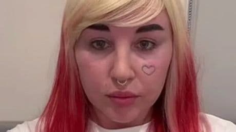Amanda Bynes shares new look with fans after lip filler procedure