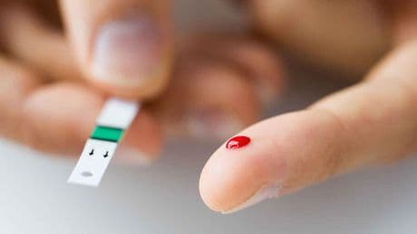 Hito científico: consiguen 'curar' la diabetes en una paciente de 25 años gracias a un trasplante de células madre