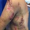 British angler cheats death after his fishing rod is struck by a lightning bolt