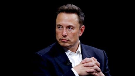 Musk tarih verdi: "Robotlar cerrahları geçecek"