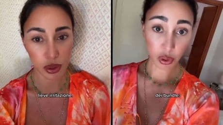"Cos'ha fatto in faccia?" Bufera social su Belen: cosa è successo