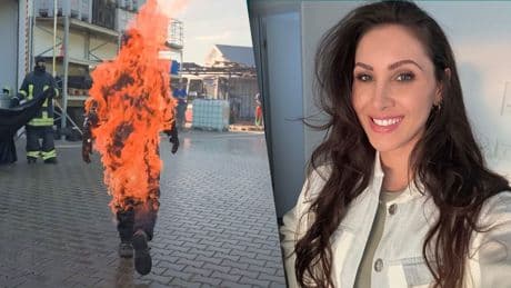 Verbrennungen zweiten Grades - YouTuberin geht in Flammen auf!