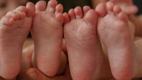 Donna incinta all'ottavo mese in ospedale in condizioni critiche, rarissimo parto podalico naturale: nate due gemelline