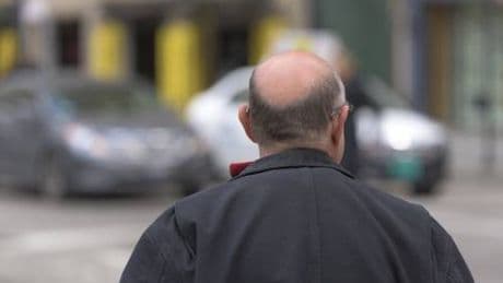 L'allarme sul farmaco contro la caduta dei capelli: cosa provoca