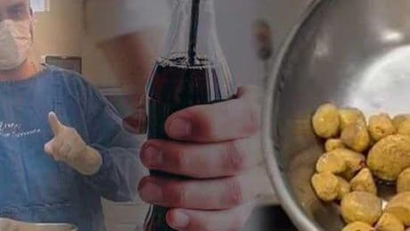 Su yerine 3 litre kola içti! Yaşadıkları korkunç, günlerdir rekor kırıyor: 'Tarlaya dönmüş'