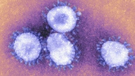 Folgen von Covid: Corona-Infektion könnte Blutgefäße altern lassen