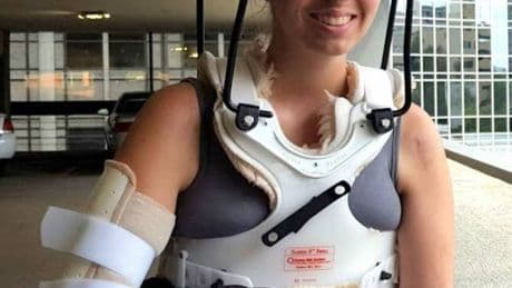 Doctors reattach ‘internally decapitated’ woman’s HEAD after her skull became detached from her spine in football injury