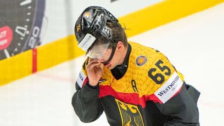 Eishockey-WM - Kieferbruch bei Deutschland-Star