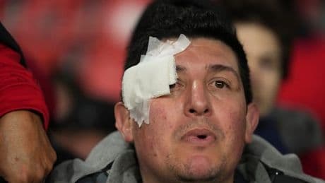 Krawalle auf den Rängen – Spiel in Buenos Aires abgebrochen