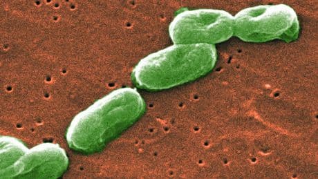 Hand soap brand recalled over presence of potentially deadly bacteria