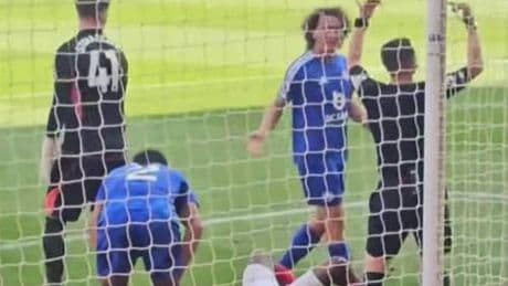 Lo scontro col palo, l'operazione d'urgenza e il coma: paura in campo per il calciatore