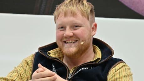 Clarkson's Farm star Kaleb Cooper suffers 'painful' injury as he shares health update from A&E