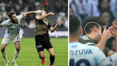 Beşiktaş'ta sakatlıklar tat kaçırdı! Yıldız oyuncunun dişi kırıldı