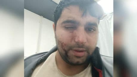 Kör eden saldırıya acele tahliye