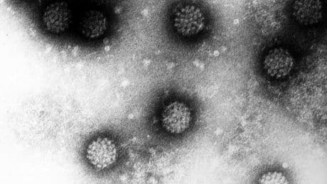 Nach Diagnose von Krebs-Vorstufe bei Vanessa Mai: Was bringt die HPV-Impfung?