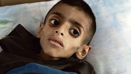 « Depuis 72 jours, pas un seul morceau de pain n’est entré » : à Gaza, « une famine délibérée et entièrement fabriquée » par Israël