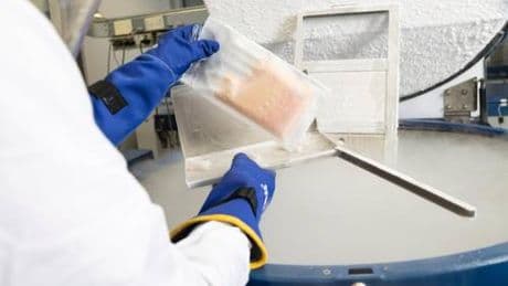 Tumori, ricostruzione seno: trapianto grasso autologo utile per pazienti e strutture