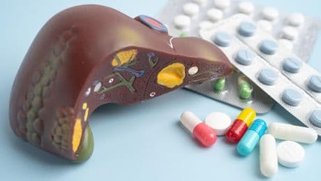 Quand l’accumulation de graisses dans le foie cache des risques de diabète, cardiaques ou de cancer