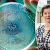 “Slecht verhit rundergehakt kan tot een besmetting leiden”: wat is de STEC-infectie die zoveel rusthuisbewoners ziek maakte?