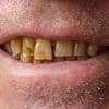 What the colour of your TEETH says about you, according to science